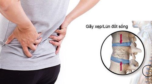 Cách điều trị bệnh xẹp mắc xương sống ở người già