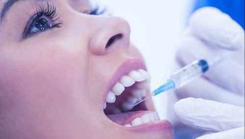 Tìm hiểu về gây tê vùng khi nhổ răng