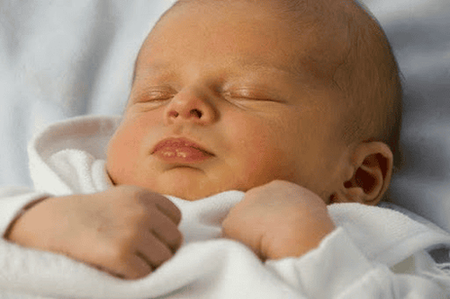 Trẻ sơ sinh bị vàng da kéo dài có phải do sữa mẹ không?