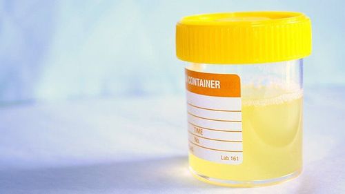 Decreased urine output: Causes, treatment, and prevention