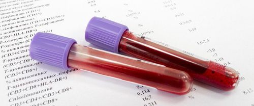 Kết quả xét nghiệm máu chỉ số lympho là 34,8% có bình thường không?
