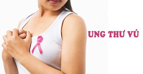 Hội chứng ung thư vú và buồng trứng di truyền