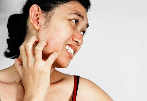 Often itchy rash in the facial skin test liver disease?