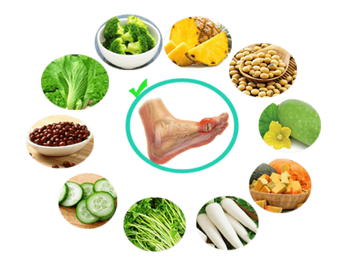Chế độ ăn dự phòng bệnh gout