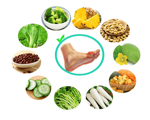 Gout prevention diet