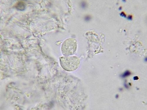 Fresh endoscopic test - white blood staining helps to detect the causative agents of vaginitis