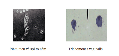 
Hình ảnh Nấm men, sợi tơ và Trichomonas vaginalis
