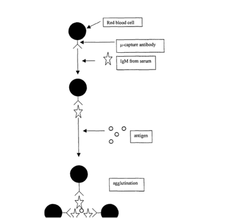 
Hình 1: Thử nghiệm hồng cầu tóm bắt IgM (the red blood cell-IgM capture assay)
