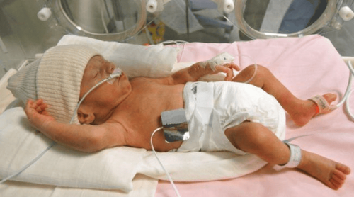 Respiratory failure in infants