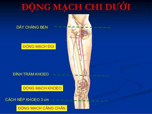 
Đường vào động mạch trong nút mạch gan hóa chất thường là từ động mạch đùi bên phải
