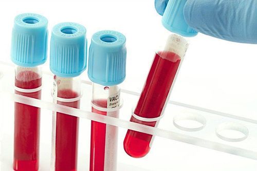 Hỏi đáp: Xét nghiệm chẩn đoán viêm gan B và viêm gan C