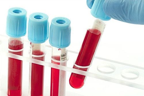 The importance of a complete blood count test