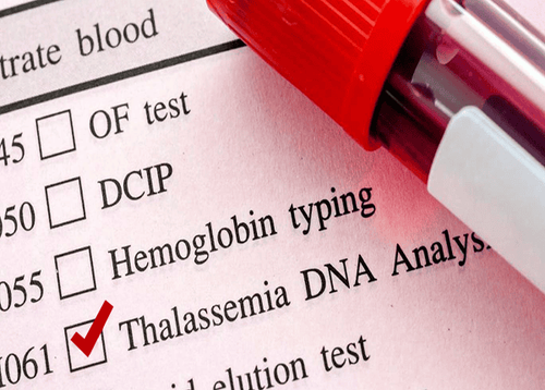 What is Thalassemia and is it treatable?