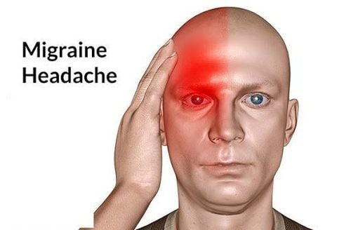 4. Biến chứng của đau đầu kiểu Migraine