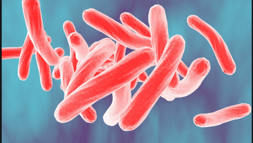 
Lao tiết niệu do nhiễm trùng Mycobacterium tuberculosis gây ra
