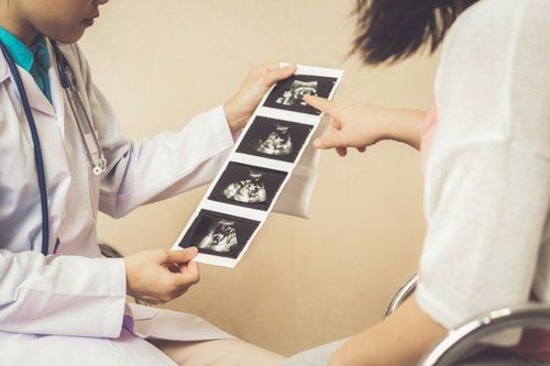 Ultrasound should be performed at three crucial stages of pregnancy.