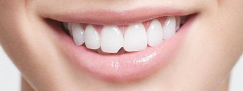 Can chipped porcelain teeth be filled?