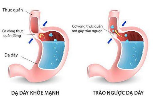 
Trào ngược dịch dạ dày vào đường thở là một tai biến sau phẫu thuật
