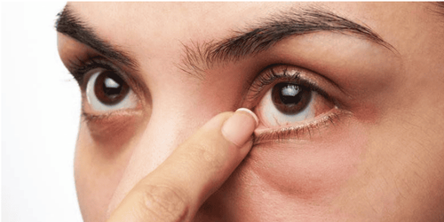 Trachoma: Causes, symptoms and treatment