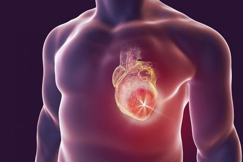 Metabolic cardiovascular syndrome