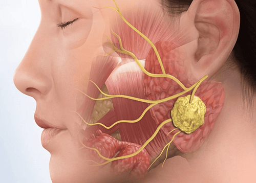 Nutrition for nasopharyngeal cancer patients