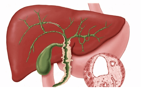 Prevention of sclerosing cholangitis