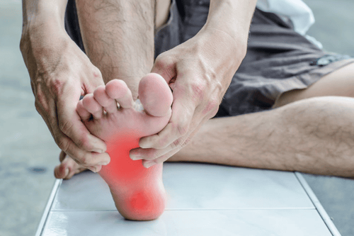 Tháo bột sau 15 ngày gãy xương lòng bàn chân có ảnh hưởng gì không?
