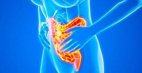 How do I know if I have Crohn's disease?