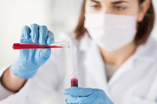 Xét nghiệm máu tổng quát bao lâu có kết quả?