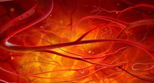 Chụp số hóa xóa nền tĩnh mạch lách - cửa để thăm dò mạch máu