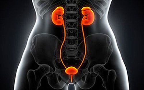 Indications for an X-ray of the urinary system with intravenous contrast (UIV)