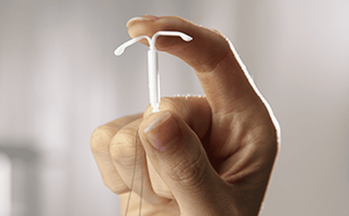 How long does it take to change an IUD?