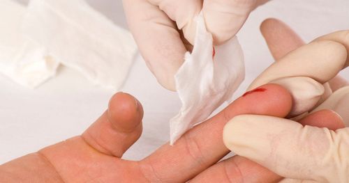 Vật sắc nhọn từ người nhiễm HIV đâm vào cơ thể có nguy cơ phơi nhiễm không?