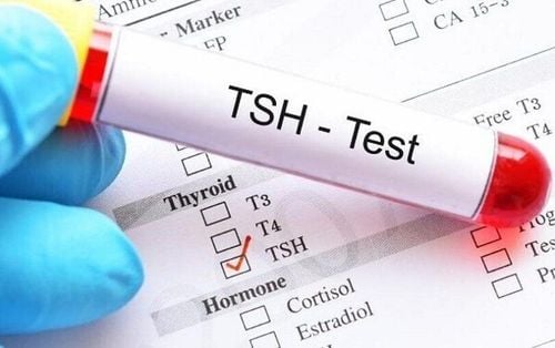 Trẻ xét nghiệm TSH chỉ số bình thường nhưng kết quả xét nghiệm máu bất thường có bị bệnh suy giáp hay không?