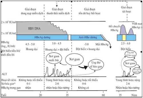 
Hình 1. Lịch sử tự nhiên của nhiễm VGB mạn mắc phải chu sinh và trong thời kỳ thơ ấu
