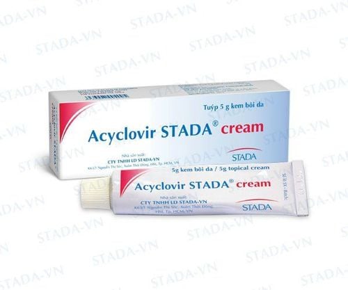 
Thuốc bôi Acyclovir giúp điều trị viêm giác mạc do virus herpes
