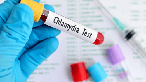 What does Chlamydia test mean?