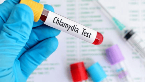 Ý nghĩa xét nghiệm Chlamydia