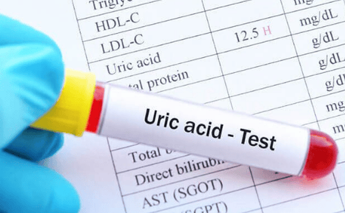 Nồng độ Acid Uric 500 có bị Gout không?