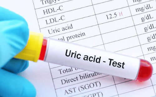 Uric acid blood biochemical test to diagnose gout