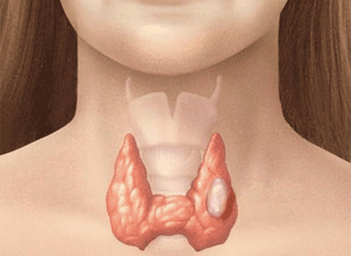 The link between stress and your thyroid