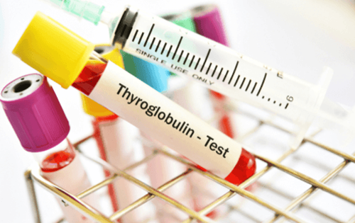 Thyroglobulin test meaning