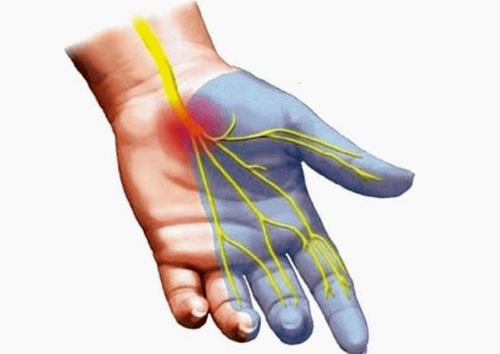 Causes and symptoms of peripheral neuropathy