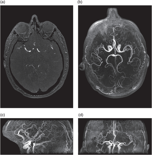 Intravenous magnetic resonance imaging procedure without injecting magnetic contrast