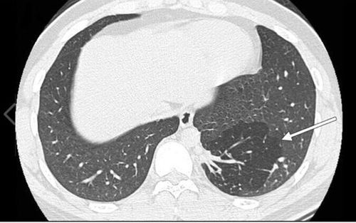 Procedure for chest magnetic resonance imaging without injection of magnetic contrast agent