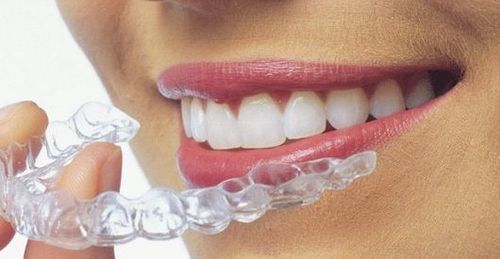 
Niềng răng invisalign đem lại độ thẩm mỹ cao
