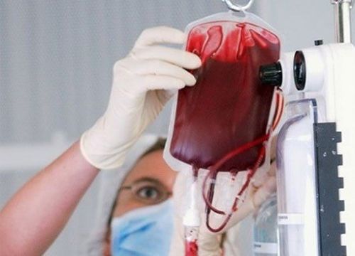 
Quá trình truyền máu gây quá tải sắt khiến bệnh nhân thalassemia thể nặng tăng nguy cơ nhiễm trùng
