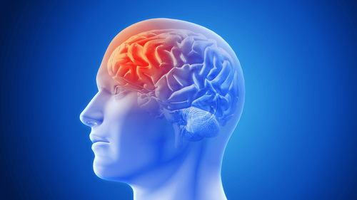 Cranial magnetic resonance imaging procedure with injection of magnetic contrast agent