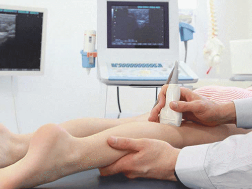 How to perform an ultrasound of the lower extremities?