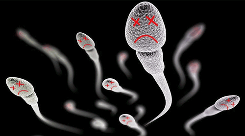 How are spermatozoa malformations treated?